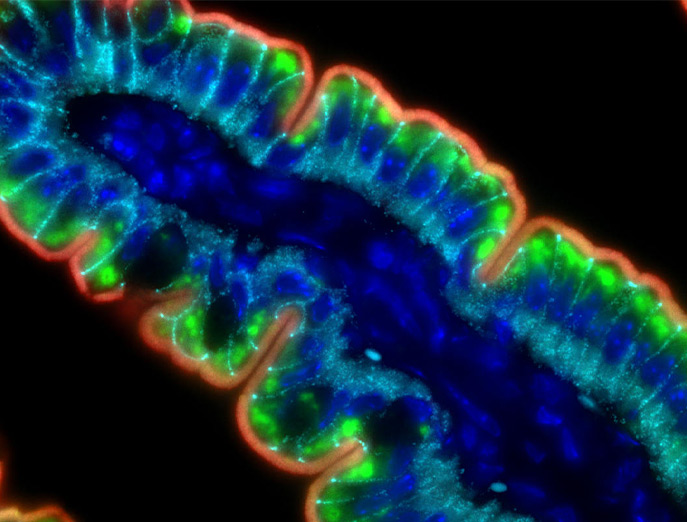 A cross section of gut villus is shown through a microscope stained green for where the GUCY2C antigen appears.