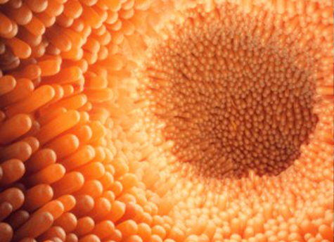 An artist’s rendering depicts the intestinal lining in bright orange/yellow hues. (Credit: Thinkstock)